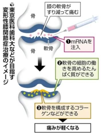 乙葉めぐみ 膝が痛いあなたへ?